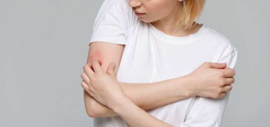 Start kampen mod fnat på Apoteket