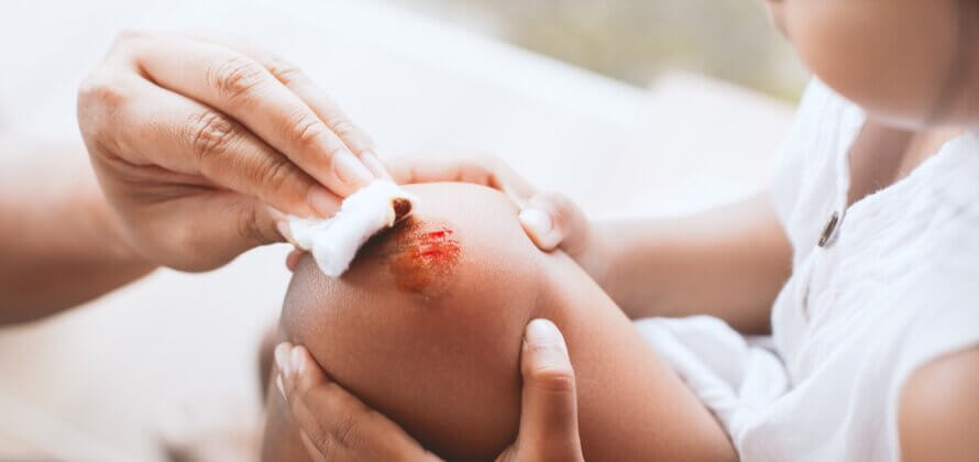 Sådan rykker du ud, når dit barn har slået sig